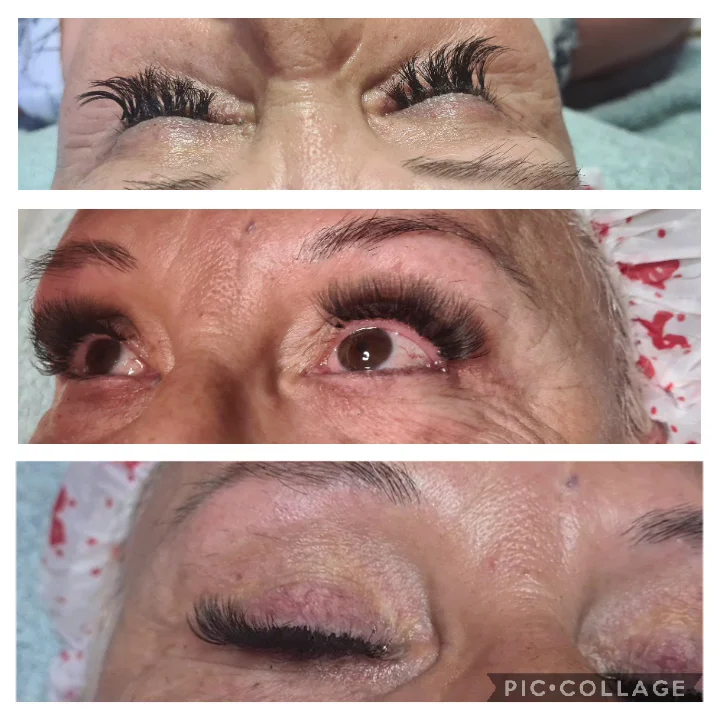 Extension Ciglia