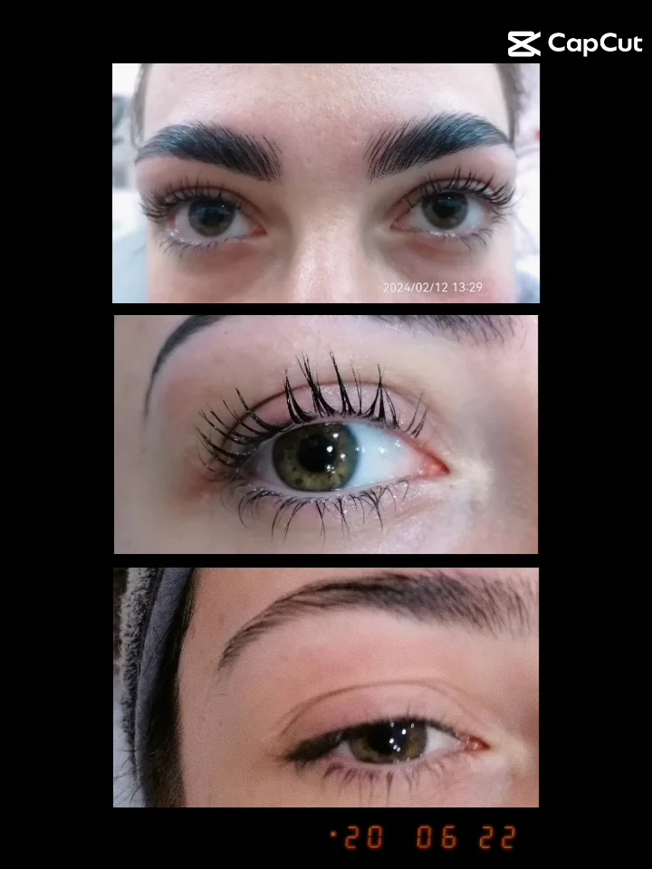 Iresò Beauty | Atelier Estetico - 3