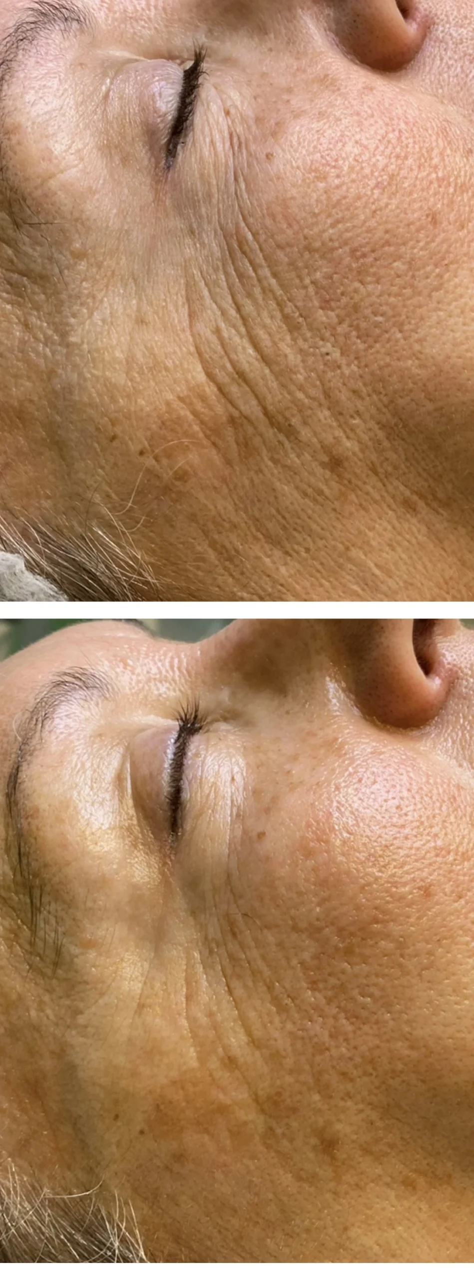 ProGenera, Face Beauty Spa